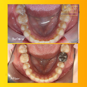 ارتودنسی-دندان-10