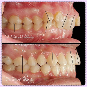 ارتودنسی-دندان-118