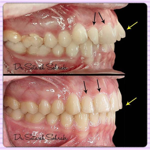 ارتودنسی-دندان-133