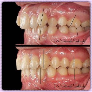 ارتودنسی-دندان-157