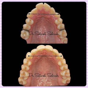 ارتودنسی-دندان-165