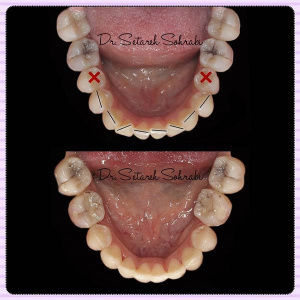ارتودنسی-دندان-209