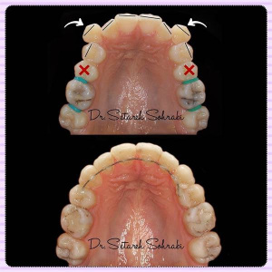 ارتودنسی-دندان-210