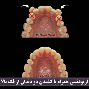 ارتودنسی-دندان-235