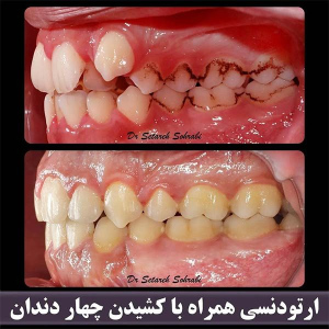 ارتودنسی-دندان-246