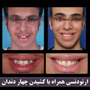 ارتودنسی-دندان-247