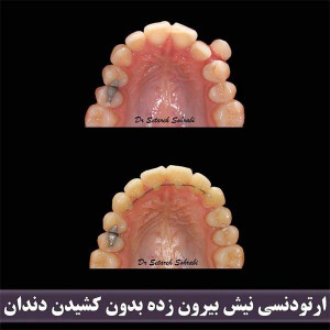 ارتودنسی-دندان-248