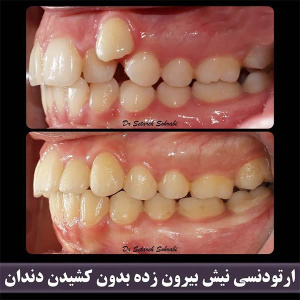 ارتودنسی-دندان-249