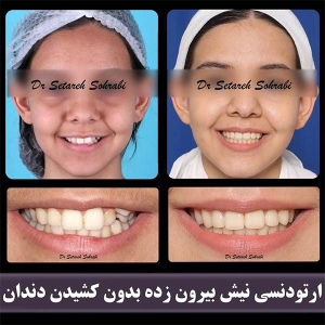 ارتودنسی-دندان-251