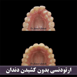 ارتودنسی-دندان-253