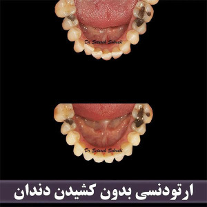 ارتودنسی-دندان-258