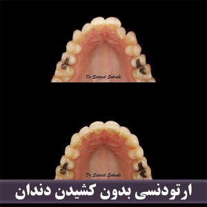 ارتودنسی-دندان-259