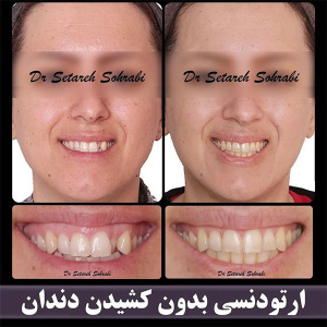 ارتودنسی-دندان-263