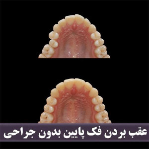 ارتودنسی-دندان-264