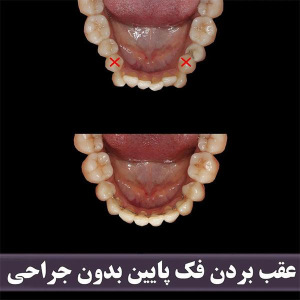 ارتودنسی-دندان-265