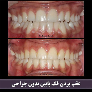 ارتودنسی-دندان-266