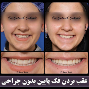 ارتودنسی-دندان-267