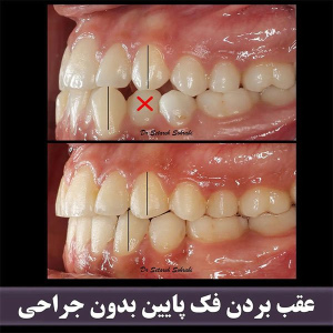 ارتودنسی-دندان-268