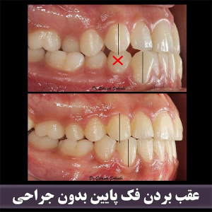 ارتودنسی-دندان-269