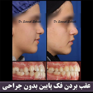 ارتودنسی-دندان-270