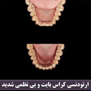 ارتودنسی-دندان-271