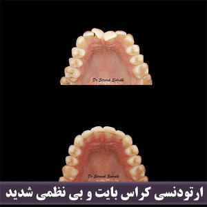 ارتودنسی-دندان-272
