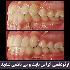 ارتودنسی-دندان-273