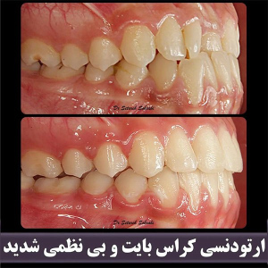 ارتودنسی-دندان-274