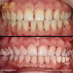 ارتودنسی-دندان-279