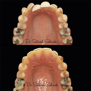 ارتودنسی-دندان-283