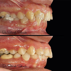 ارتودنسی-دندان-284