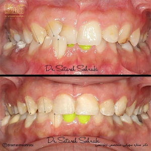 ارتودنسی-دندان-286