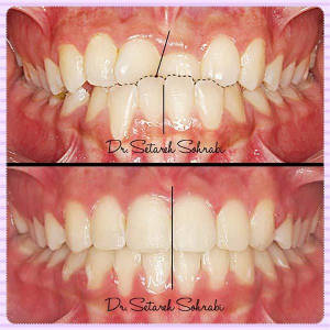 ارتودنسی-دندان138