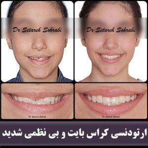 اصلاح طرح لبخند- دکتر ستاره سهرابی