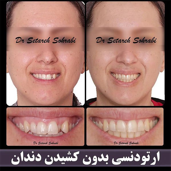 بهترین متخصص ارتودنسی دندان در کرج - دکتر ستاره سهرابی-drsetarehsohrabi.com