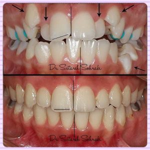 متخصص ارتودنسی کرج - دکتر ستاره سهرابی-drsetarehsohrabi.com