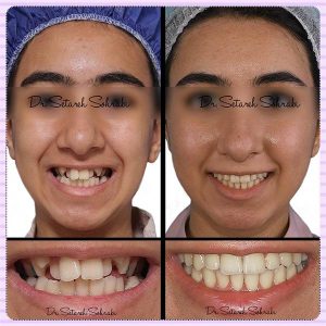 متخصص ارتودنسی کرج - دکتر ستاره سهرابی-drsetarehsohrabi.com