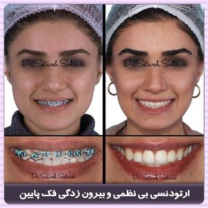 متخصص ارتودنسی کرج - دکتر ستاره سهرابی