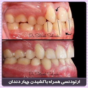 متخصص ارتودنسی کرج - دکتر ستاره سهرابی-drsetarehsohrabi.com