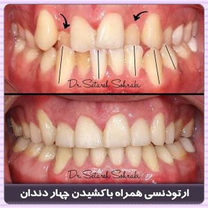 متخصص ارتودنسی کرج - دکتر ستاره سهرابی-drsetarehsohrabi.com