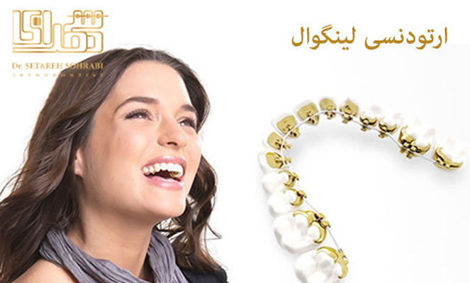 ارتودنسی لینگوال