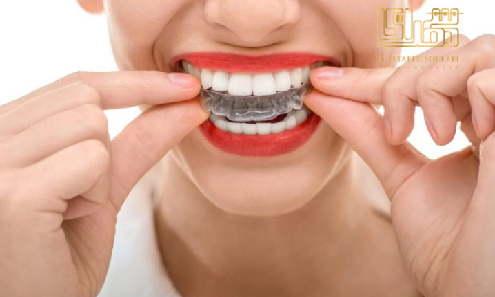 ارتودنسی الاینر