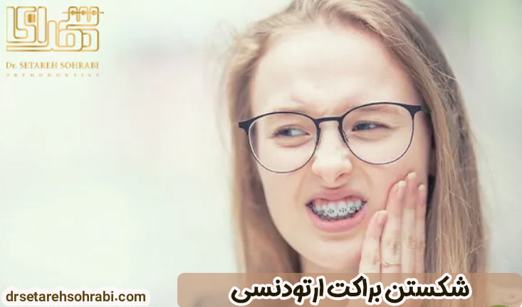 شکستن براکت ارتودنسی