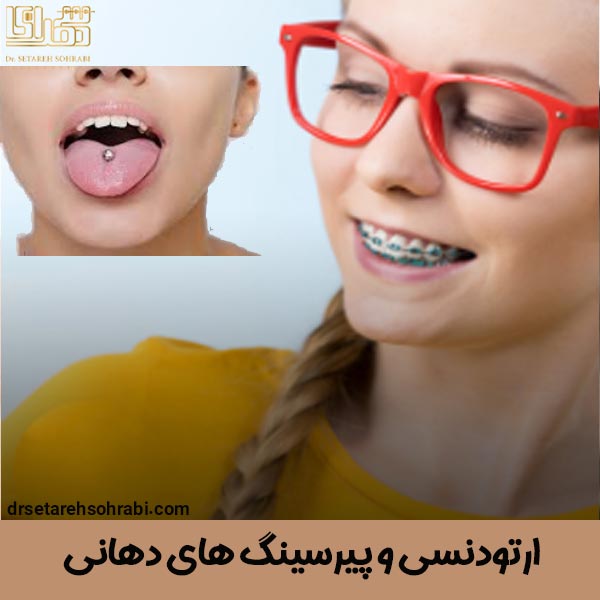 ارتودنسی و پیرسینگ های دهانی