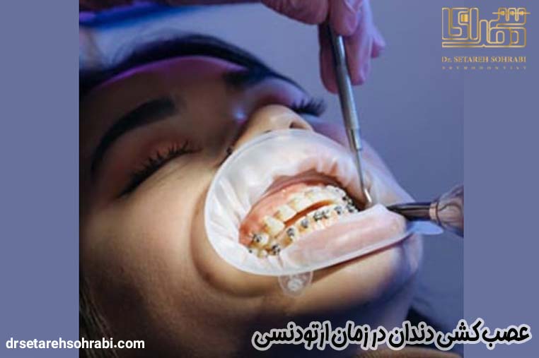 عصب کشی دندان در زمان ارتودنسی