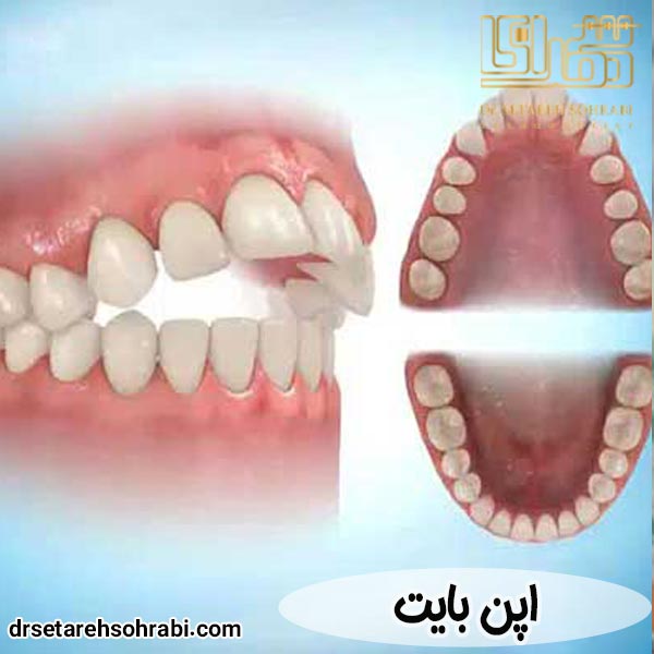 اپن بایت