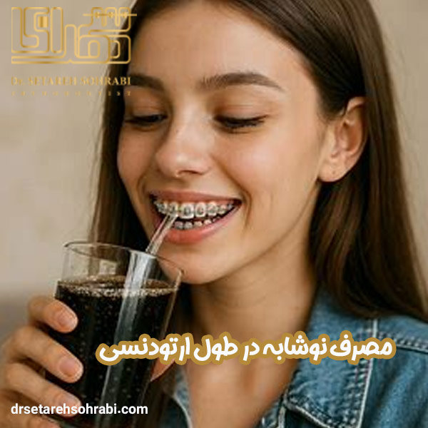 مصرف نوشابه در طول ارتودنسی - دکتر ستاره سهرابی - drsetarehsohrabi.com