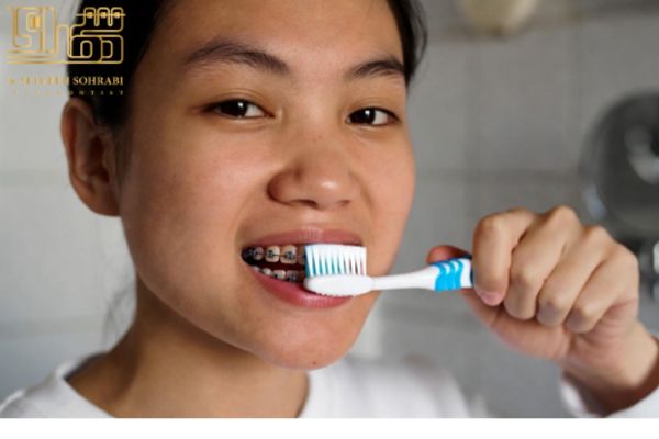 استفاده از مسواک ارتودنسی